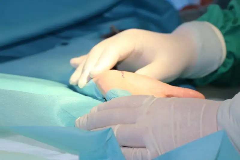 Ambulantes Operieren